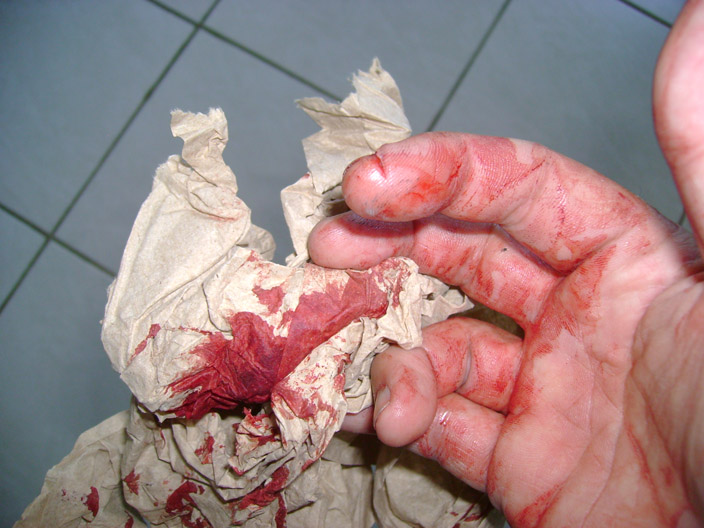 Name:  finger2_zpsec936039.jpg
Views: 139
Size:  123.0 KB